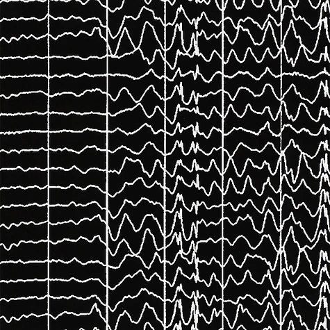 Abe Duque / Matuss - Seizure No. 11